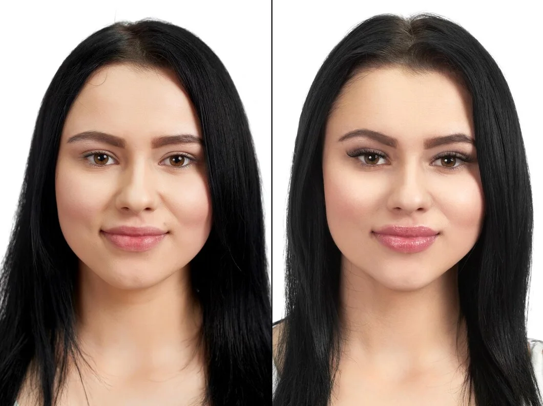 kris jenner face lift before and after